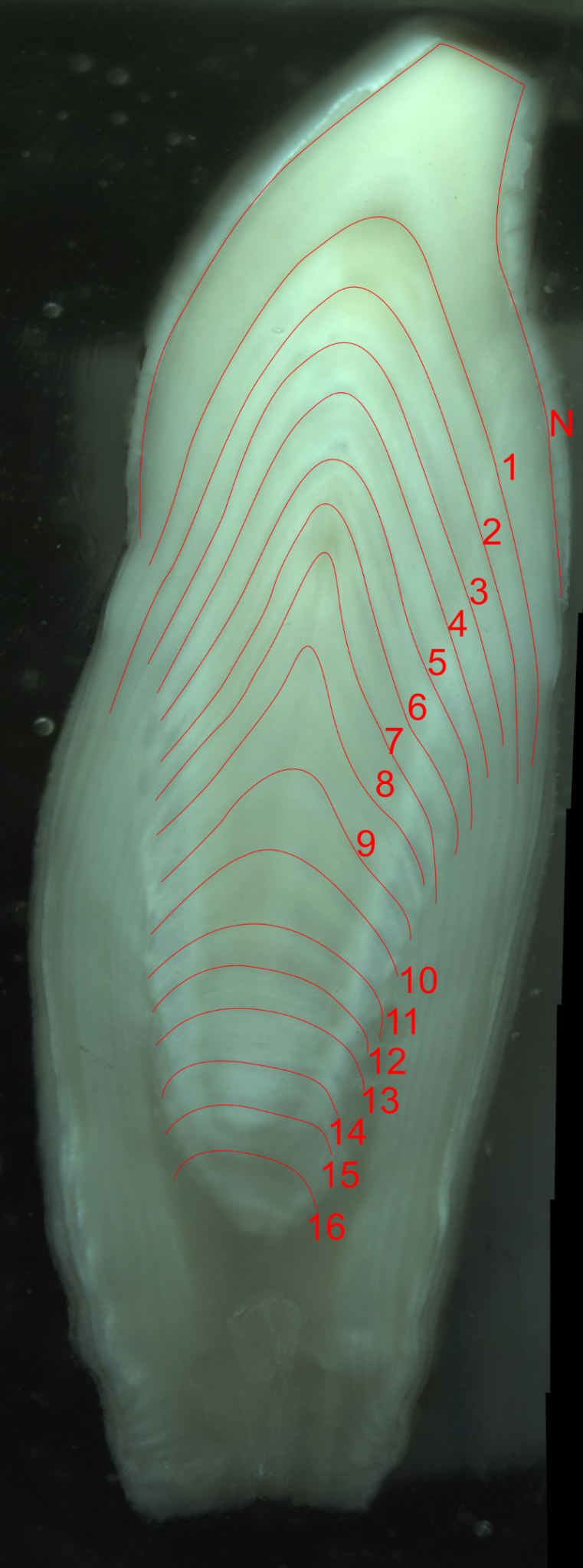 Sousa Tooth GLG